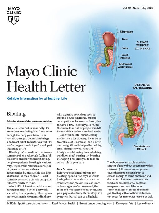 Cover image for May 2024. Mayo Clinic Health Letter